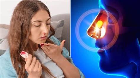 hamster blöder näsblod